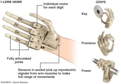 artificial-arm-winner-2.jpg